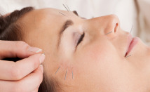 Facial Rejuvenation and Cosmetic Acupuncture